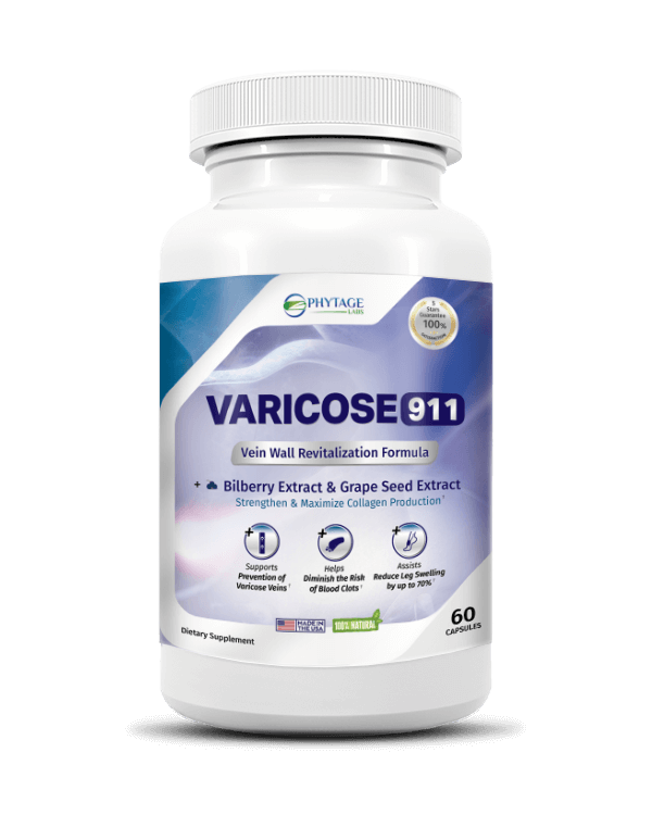 Varicose 911